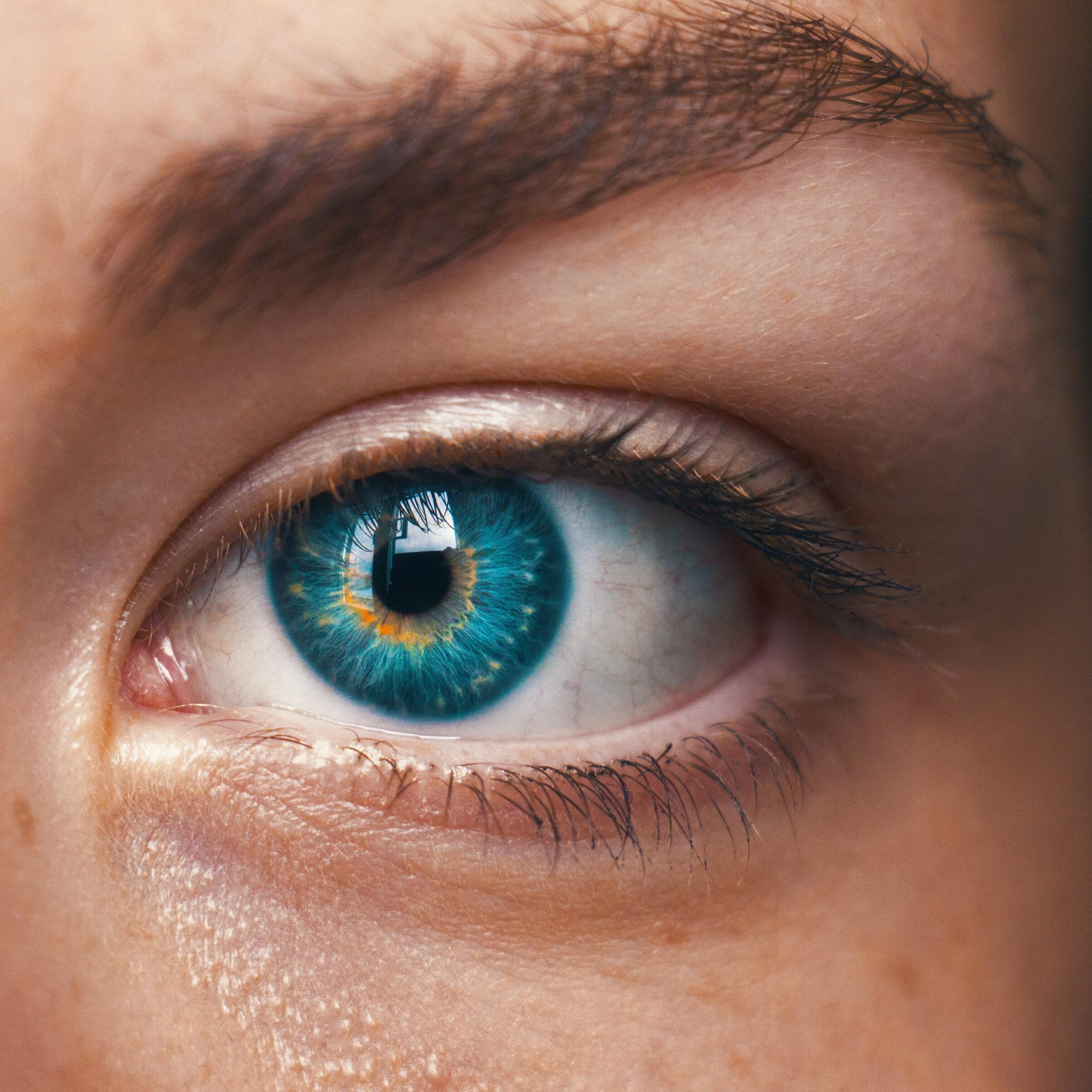 Eye